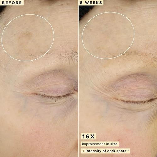 Miniatura 5 de Farmacy Suero facial 10% de vitamina C para la cara, suero facial sin agua con vitamina C y removedor de manchas oscuras para la cara, suero