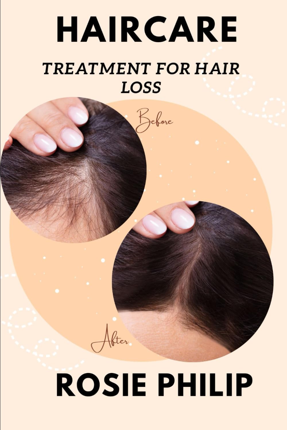 Haircare: Treatment for hair loss