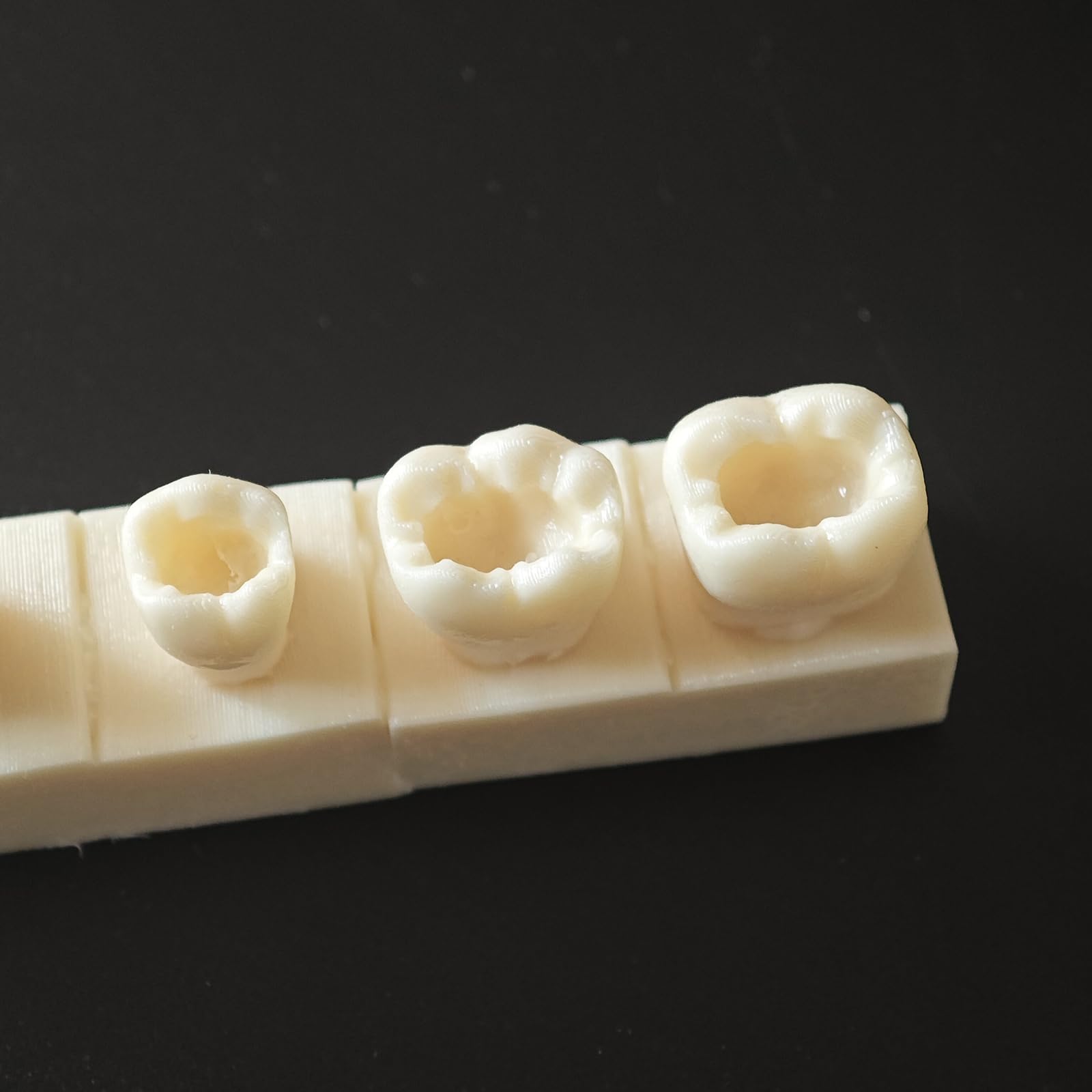 Modello di Pratica per otturazioni dentali in Resina 4 Pezzi Modello di cavità di Classe II Typodont per Studio e insegnamento