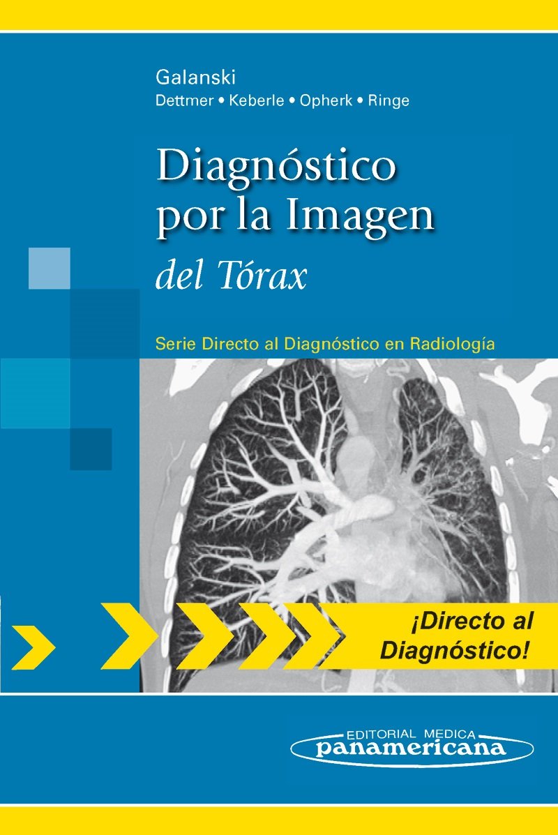 Radiografia De Torax Instavel