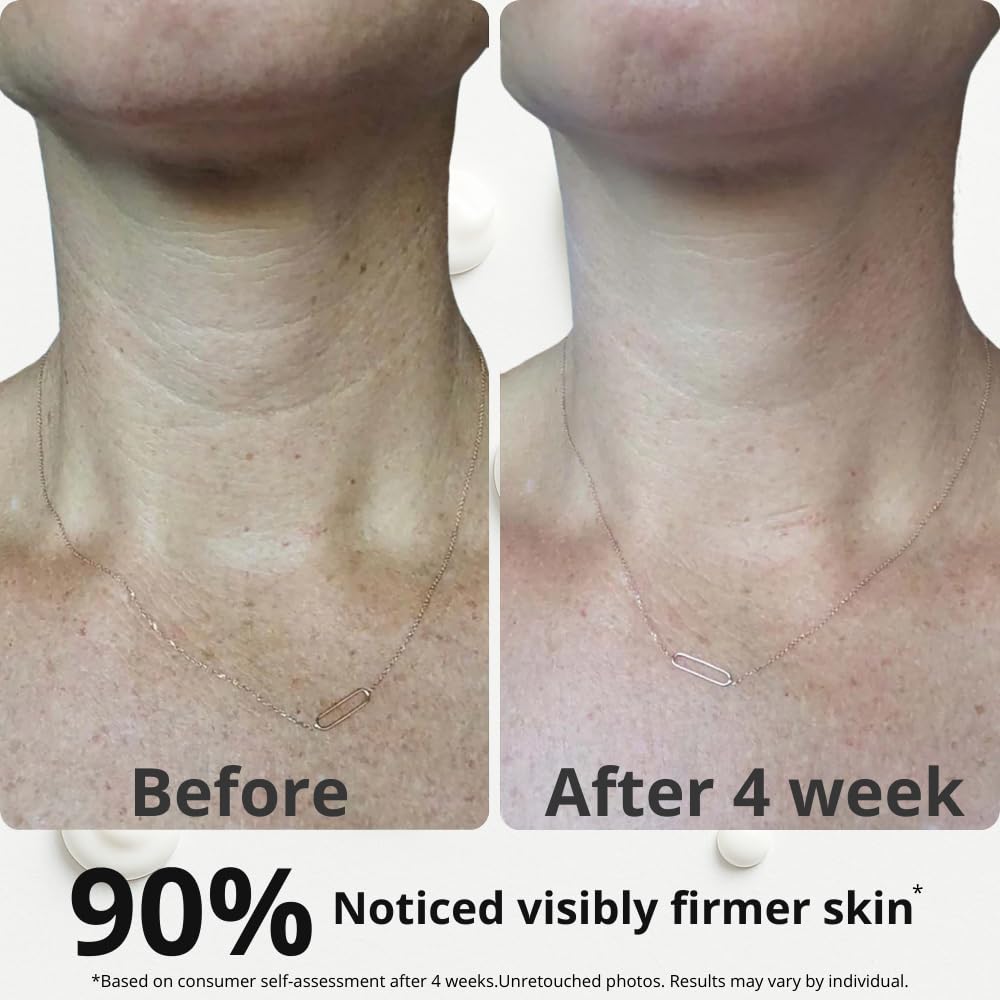 Neck Tightening Cream with Argireline AH-8, Bakuchiol, Hyaluronic Acid & Alpha Arbutin – Firming Moisturizer for Face, Neck & Décolleté – Anti-Wrinkle Cream for Women & Men – 1.76 Oz
