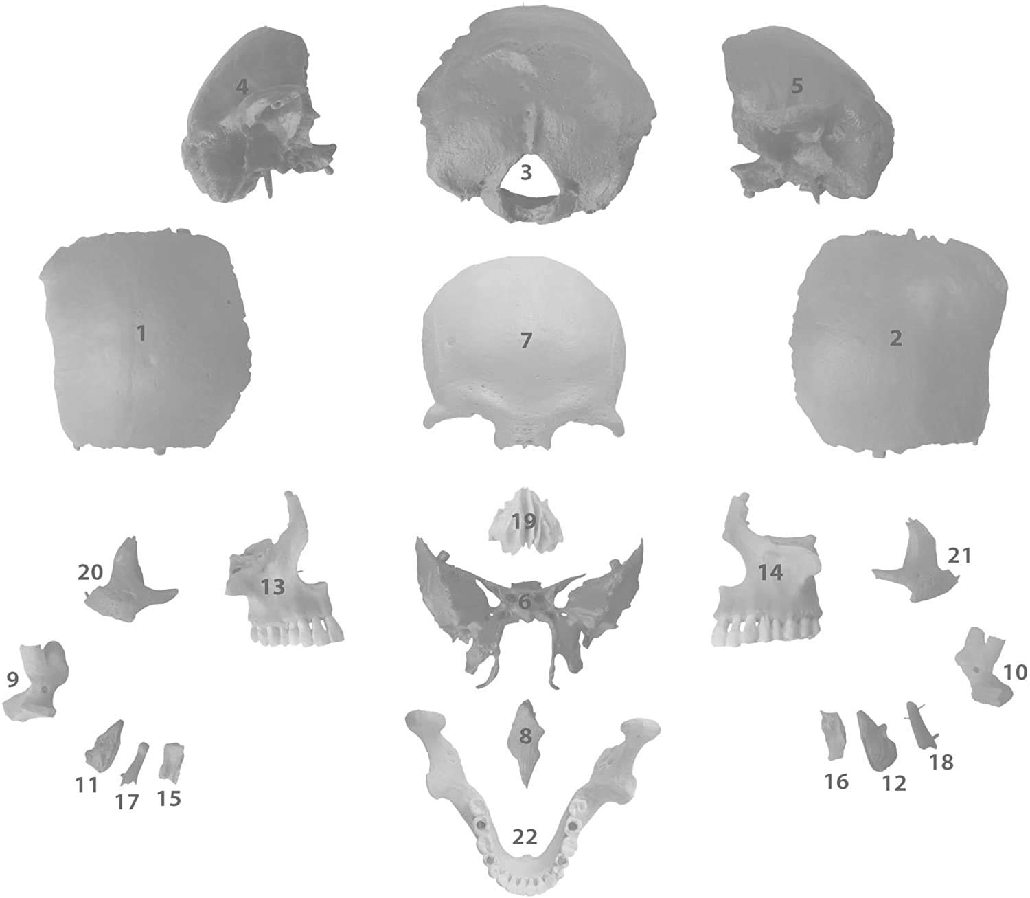 Cranstein A-217 osteopatia model czaszki, 22-częściowy, wersja anatomiczna