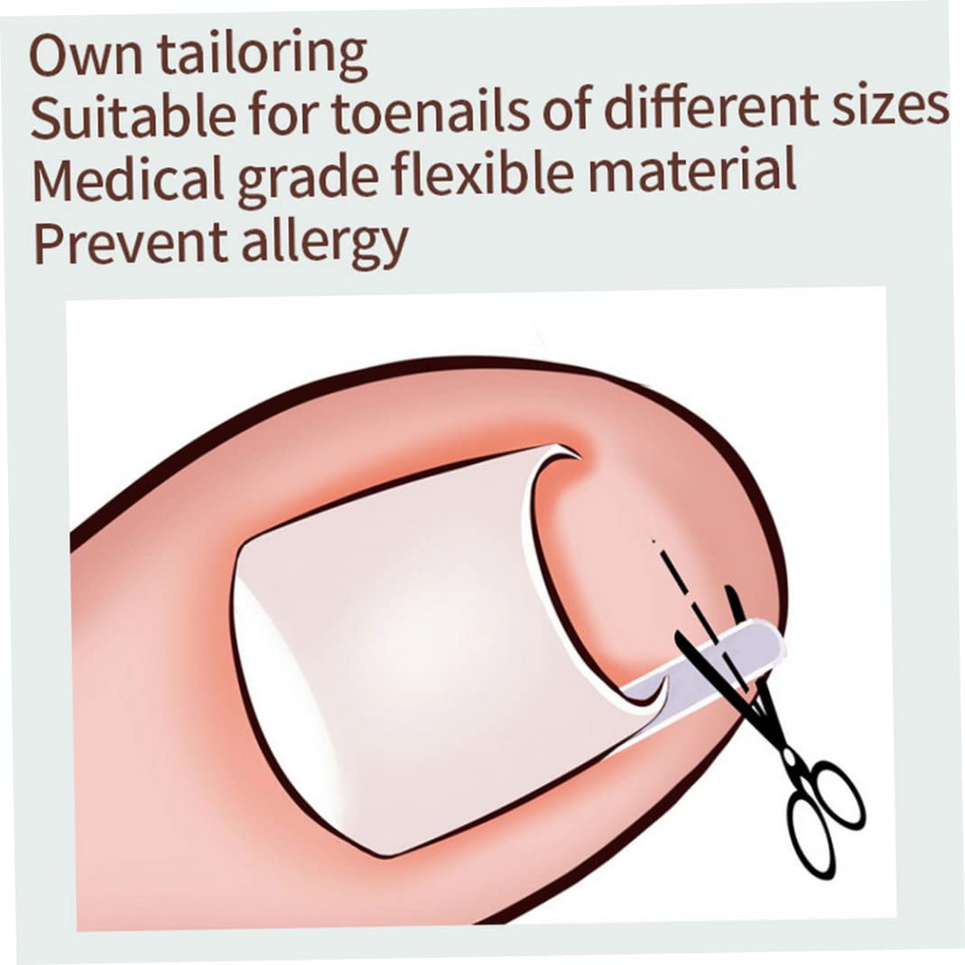 10PCS Ingrown Toenail Corrector Strips Foot Corrector Straightener Clip Curved Bs Brace Toenails Thick Correction Foot Tool