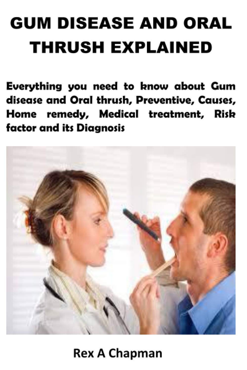 Buy GUM DISEASE AND ORAL THRUSH EXPLAINED Everything you need to know