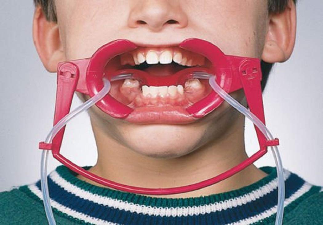 Buy Sino Dental Oral Dry Field System Nola Retractor,Orthodontic Teeth