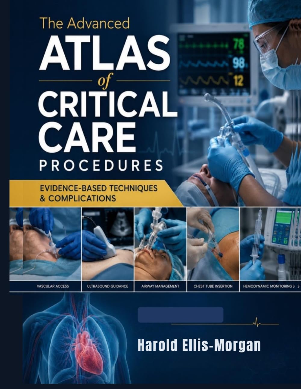 The Advanced Atlas of Critical Care Procedures: Evidence-Based Techniques & Complications