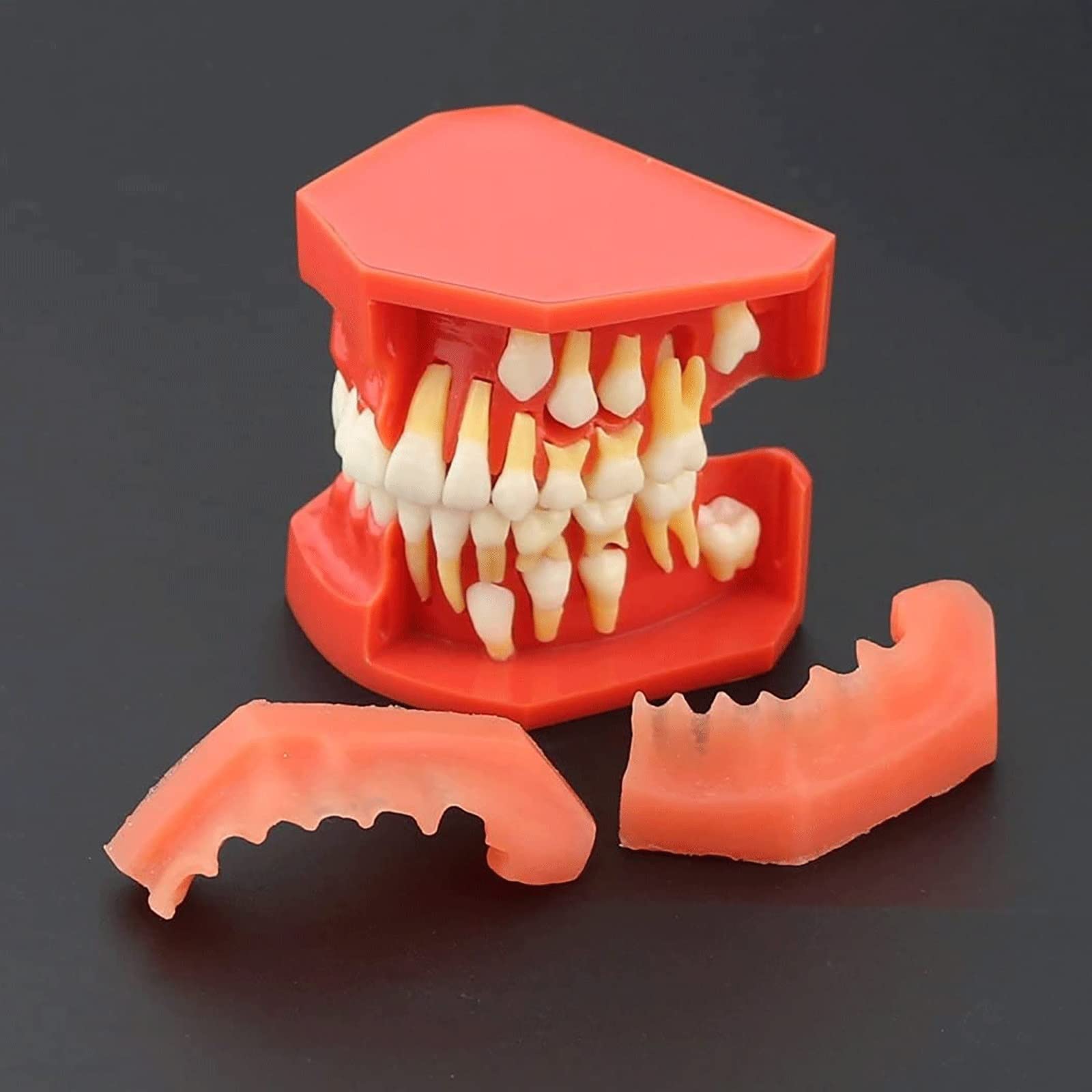 Modelli di Insegnamento Dentale, Modello di Dimostrazione Dentale per Denti Rimovibili per Malattie Dentali Modello per La Cura dei Denti Dentali per Bambini di 9-12 Anni