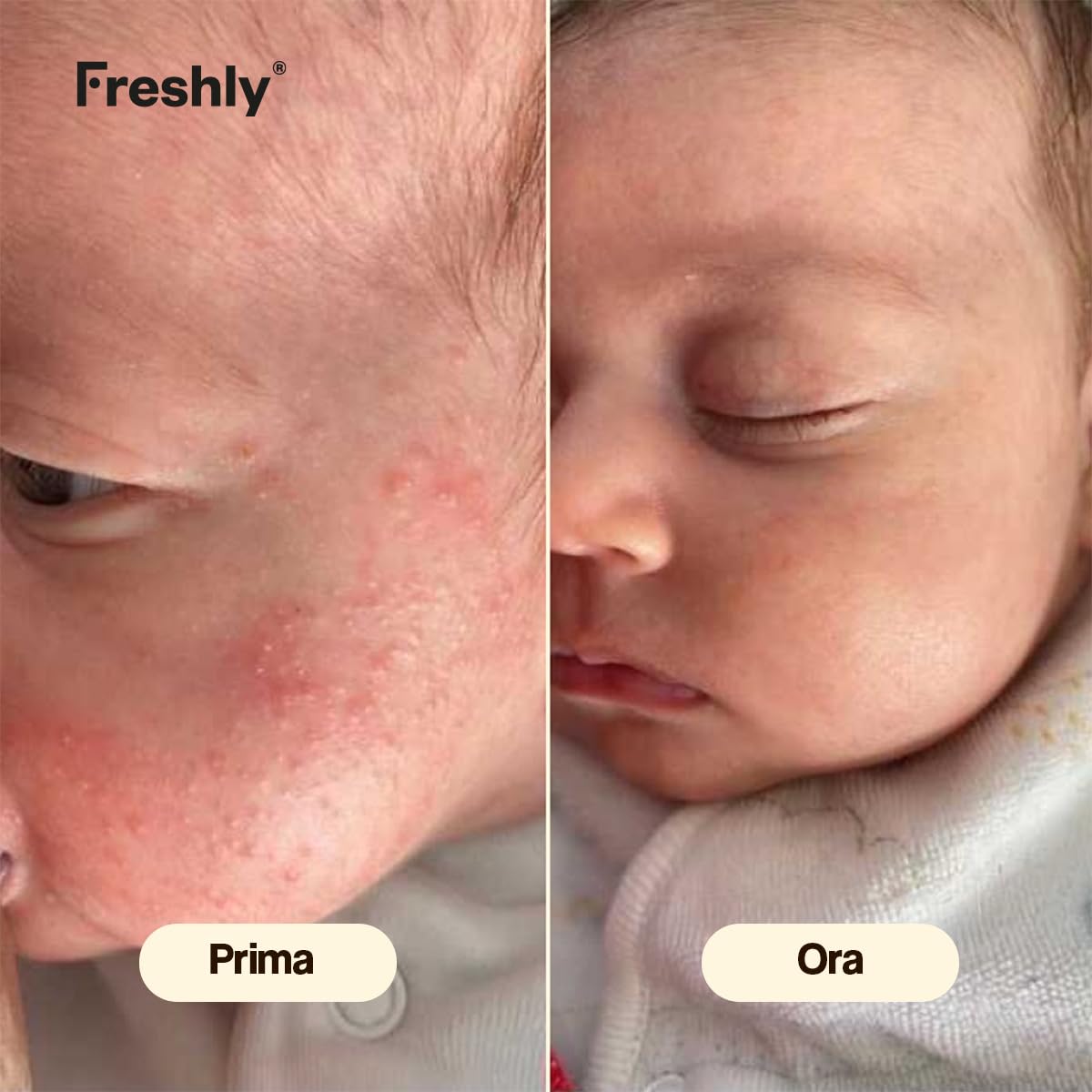 Freshly Cosmetics | Calming Sunflower + Sweet Apple Pack | Crema Viso 50 ml + Crema Corpo 400 ml | Routine Idratante per Neonati e Bambini con Pelle Sensibile