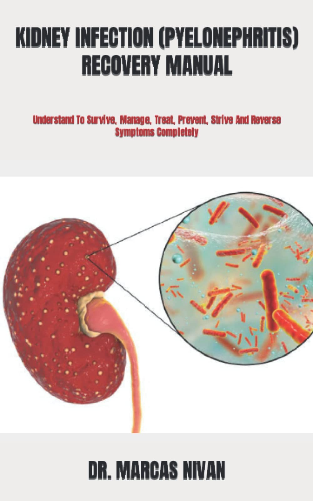 Buy KIDNEY INFECTION (PYELONEPHRITIS) RECOVERY MANUAL Understand To