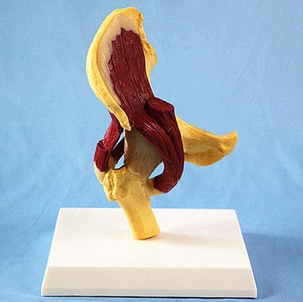 Anatomiczny Model Narządów Człowieka, Obejmujący Model Stawu Biodrowego, Przedstawia Związek Między Ludzką Kością Udową, Miednicą I Mięśniami.