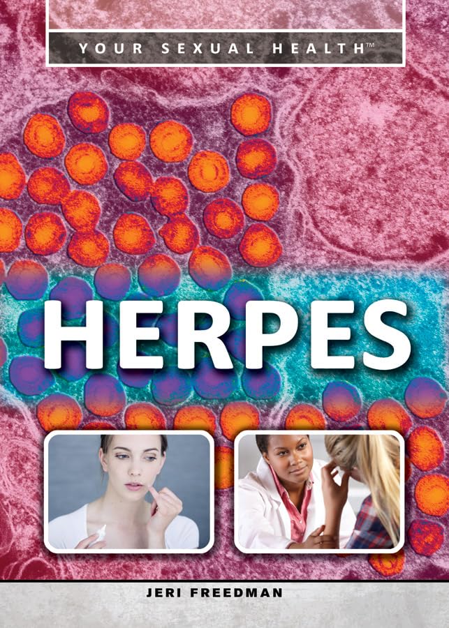 Herpes (Your Sexual Health)      Library Binding – July 30, 2015