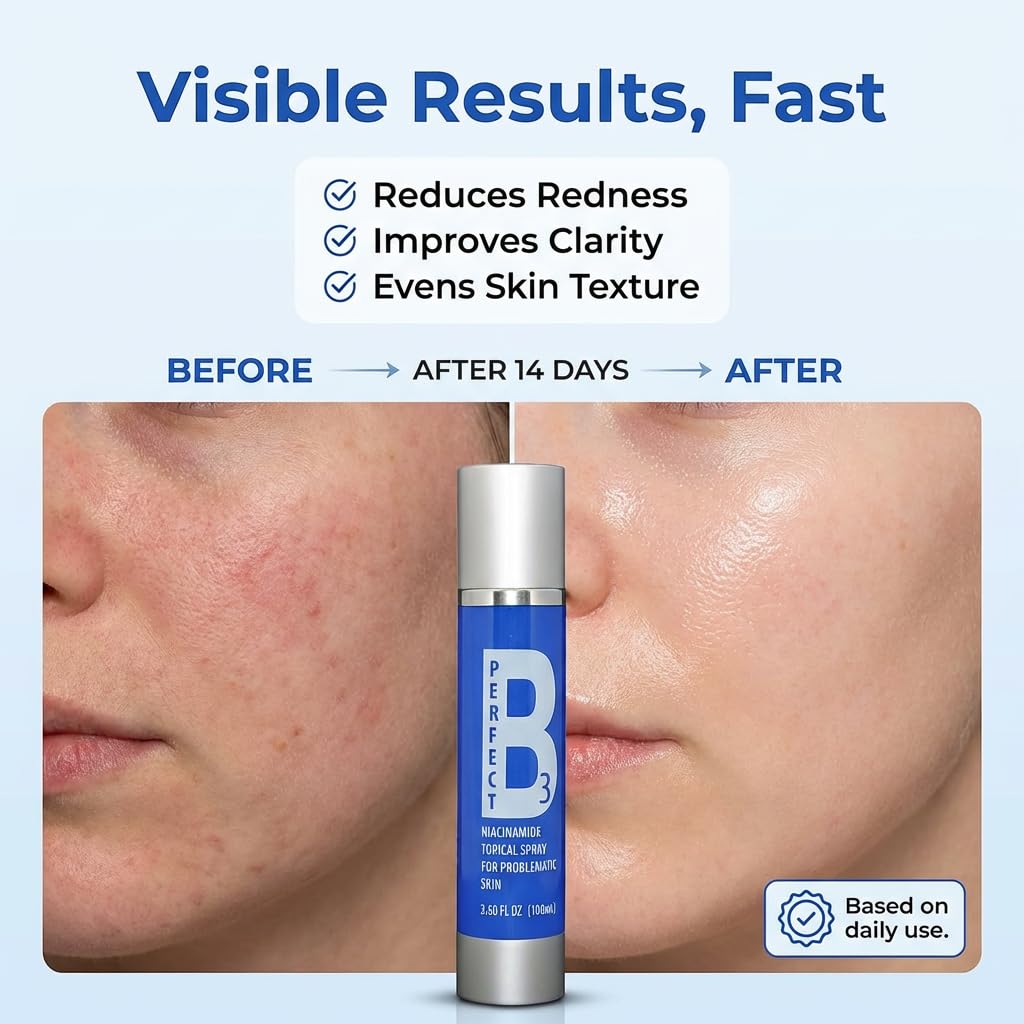 Perfect B3 Niacinamide Face Spray with Vitamin B3
