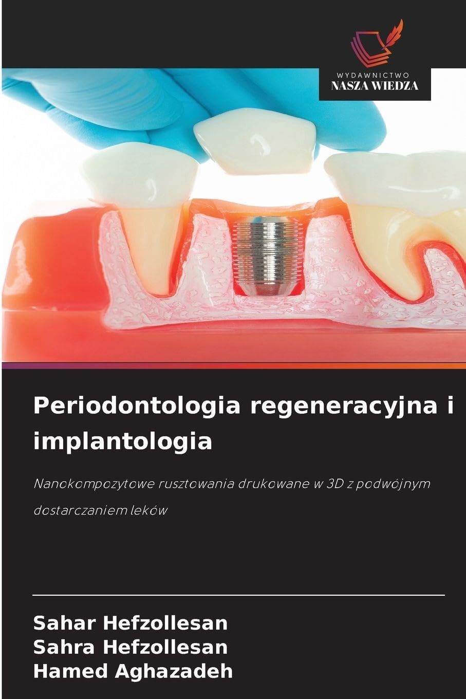 Periodontologia regeneracyjna i implantologia: Nanokompozytowe rusztowania drukowane w 3D z podwójnym dostarczaniem leków