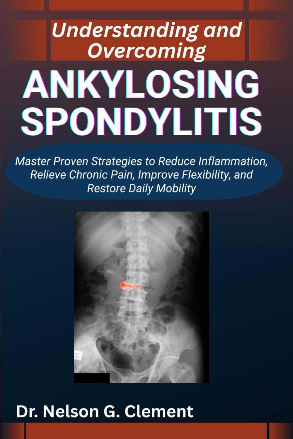 UNDERSTANDING AND OVERCOMING ANKYLOSING SPONDYLITIS: Master Proven Strategies to Reduce Inflammation, Relieve Chronic Pain, Improve Flexibility, and Restore Daily Mobility