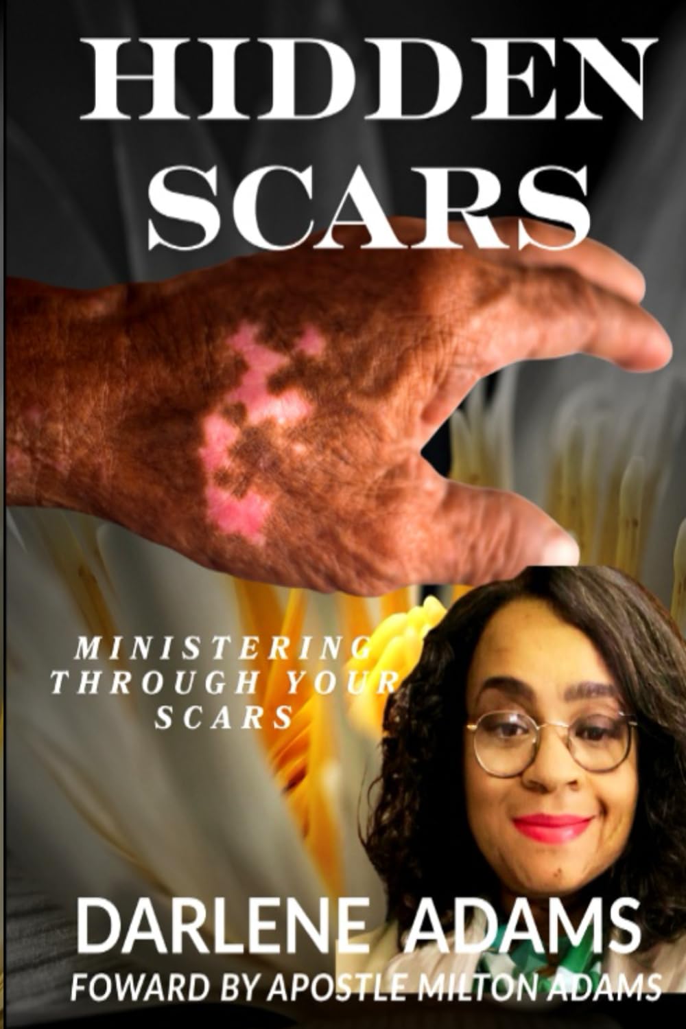 HIDDEN SCARS: Ministering Through Your Scars