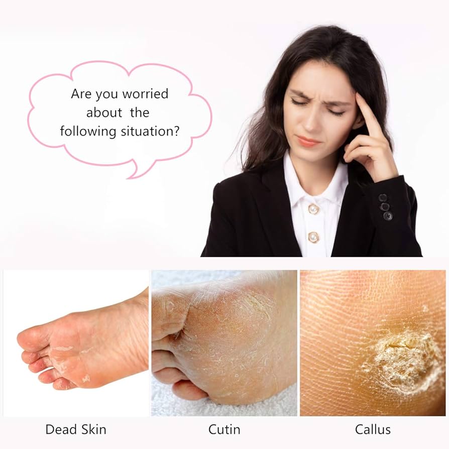 フットケア nanashi ヨドバシ.com - エブリユー フットケア 足裏角質パックAG 金木犀