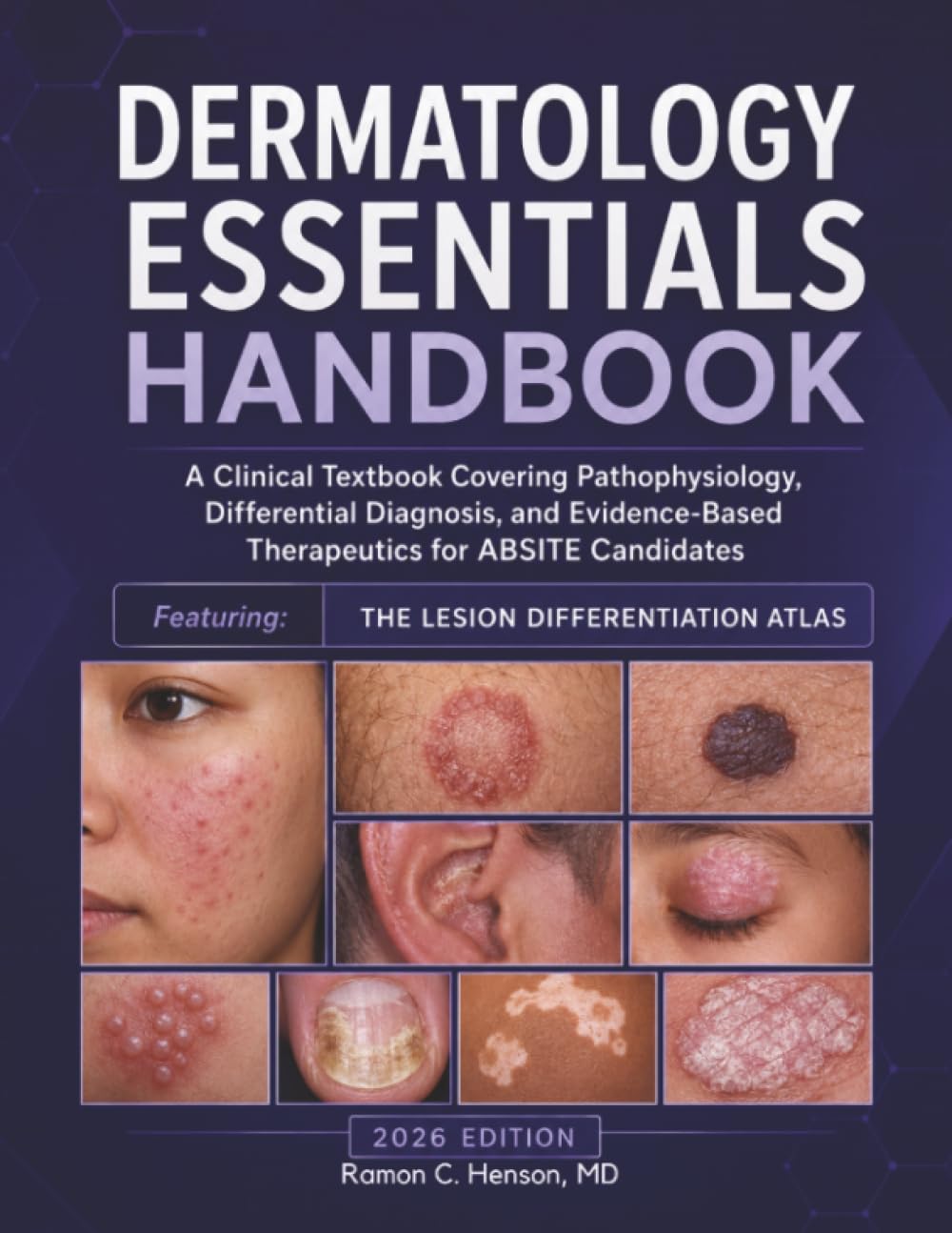 Dermatology Essentials Handbook: A Clinical Textbook Covering Pathophysiology, Differential Diagnosis, and Evidence-Based Therapeutics for ABSITE Candidates