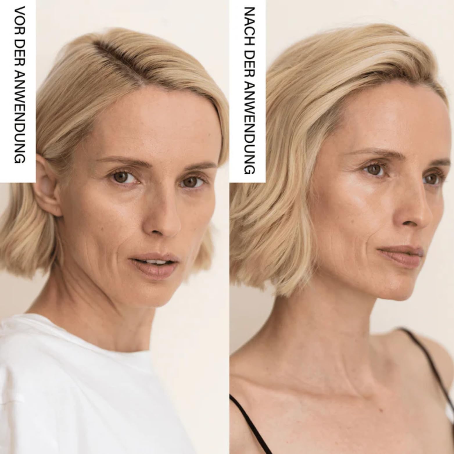 Rosental Organics LED Face Mask – LED-Gesichtsmaske für die Skincare-Routine – mit rotem & nahem Infrarot-Licht – Beauty-Maske für Zuhause