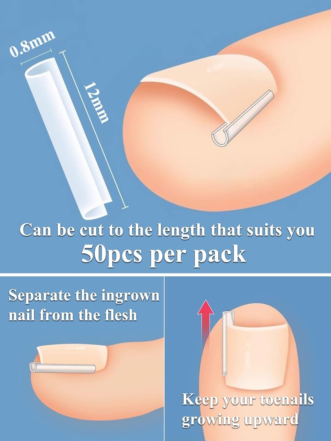kit de Traitement des Ongles Incarnés – Pince à Ongles Incarnés et Outils de Correction avec Instruments en Acier Inoxydable