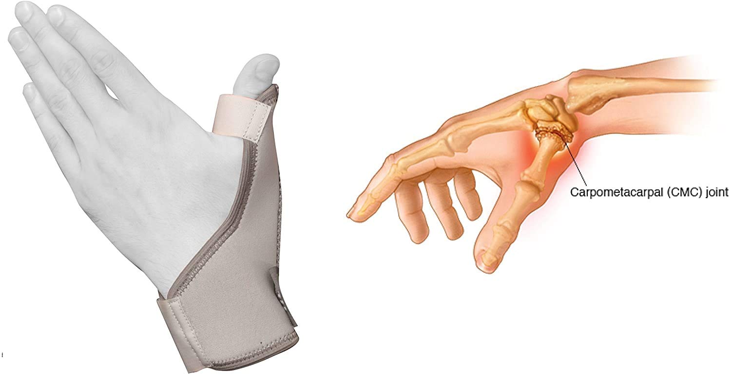 Aluminiowy pasek na kciuk (oferta pary) – stabilizator kciuka z metalowym szynem i regulowanym paskiem na nadgarstek – łagodzący ból urazów / złamanie/średni nerw (unisex) (mały, szary)
