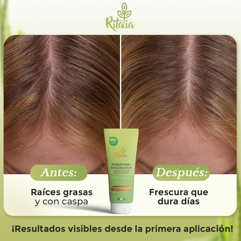 Ritalia® EXFOLIANTE CAPILAR Grande 250ml BIO sin sulfatos ni parabenos, Exfoliante cuero cabelludo SCALP SCRUB cabello graso o seco Micro peeling capilar desintoxica purifica y reequilibra
