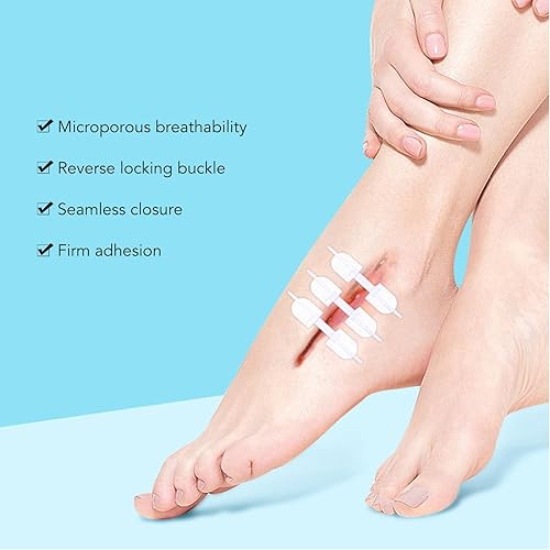 Miniatura 2 de Tira de cierre de heridas, 3 piezas de puntadas de cierre de heridas de emergencia, dispositivo de cierre de heridas autoadhesivas, kit de suturas