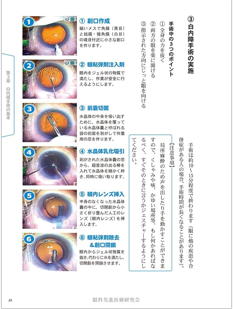 Amazon.co.jp: よし、白内障手術を受けよう! (最先端医療