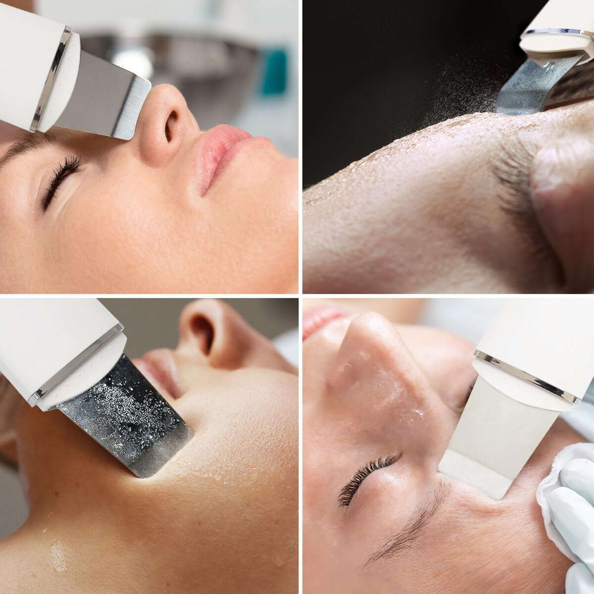 Rio The Beauty Specialist Pulizia del viso elettrica, Pulizia pori in profondità, Frequenze ad alta intensità esfoliano delicatamente, aspiratore sebo, USB FASC2