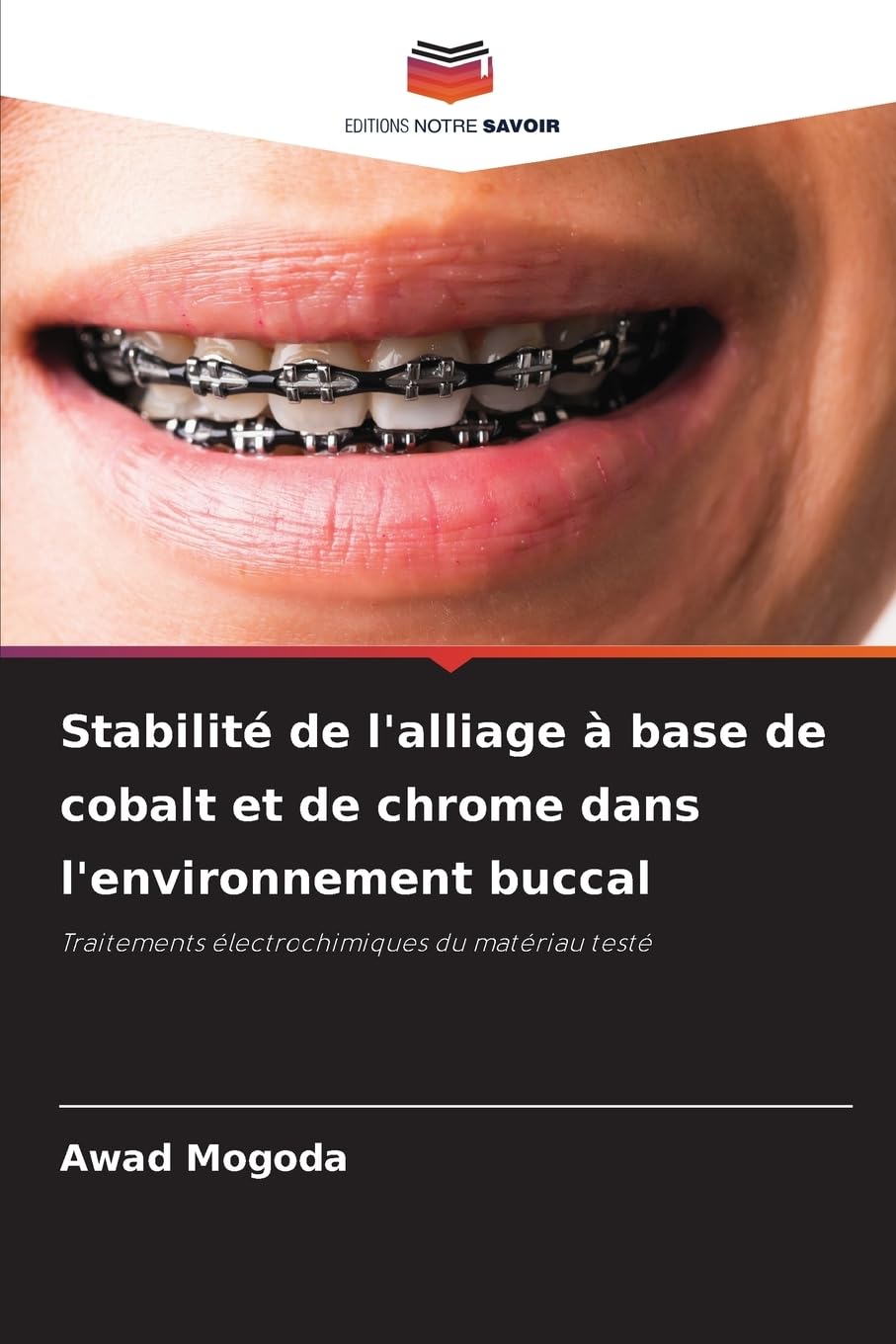 Stabilité de l'alliage à base de cobalt et de chrome dans l'environnement buccal: Traitements électrochimiques du matériau testé