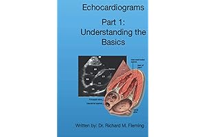 Echocardiograms: Unveiling the Basics - Part 1