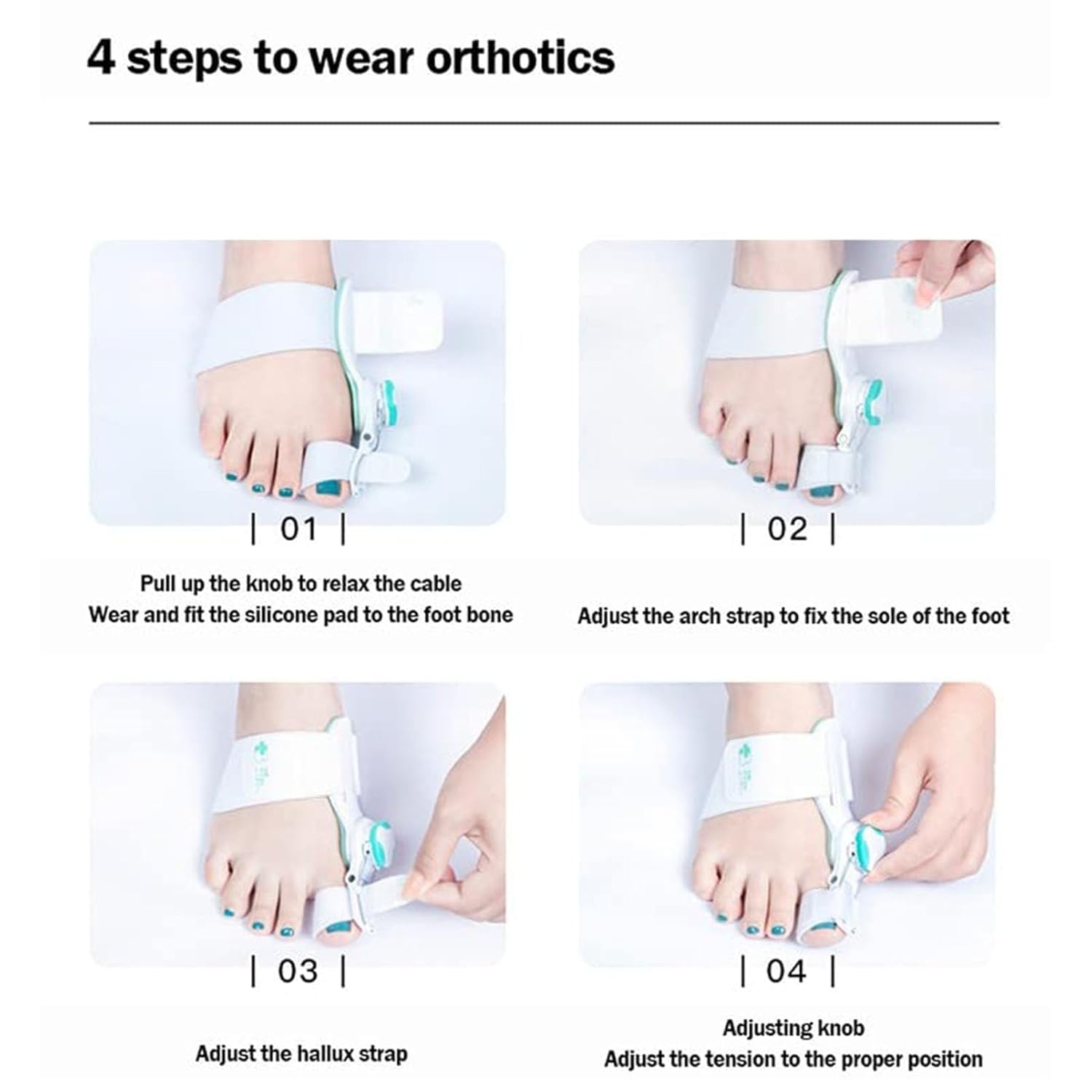 Ortesis para juanetes, enderezador del Dedo Gordo del pie, férula Ajustable para juanetes con corrección de Perilla, restauración del Arco Transversal Correcto, corrección del Hallux valgus