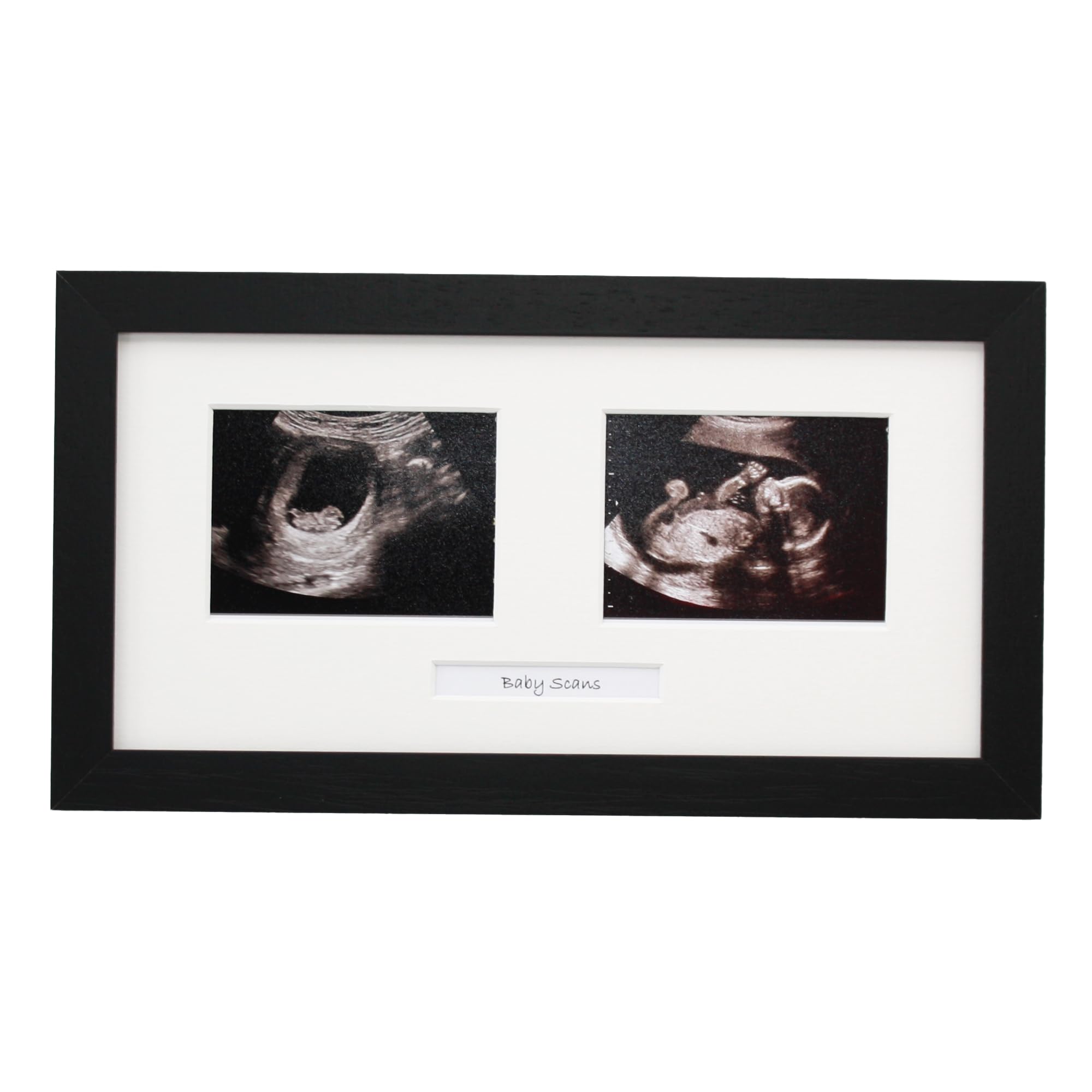 Baby Scan Photo Frame. Optional Personalisation. Multi Aperture Frame to display Two Ultra sound photographs. Pregnancy announcment | Baby Shower | Pregnancy Keepsake (Black Frame)