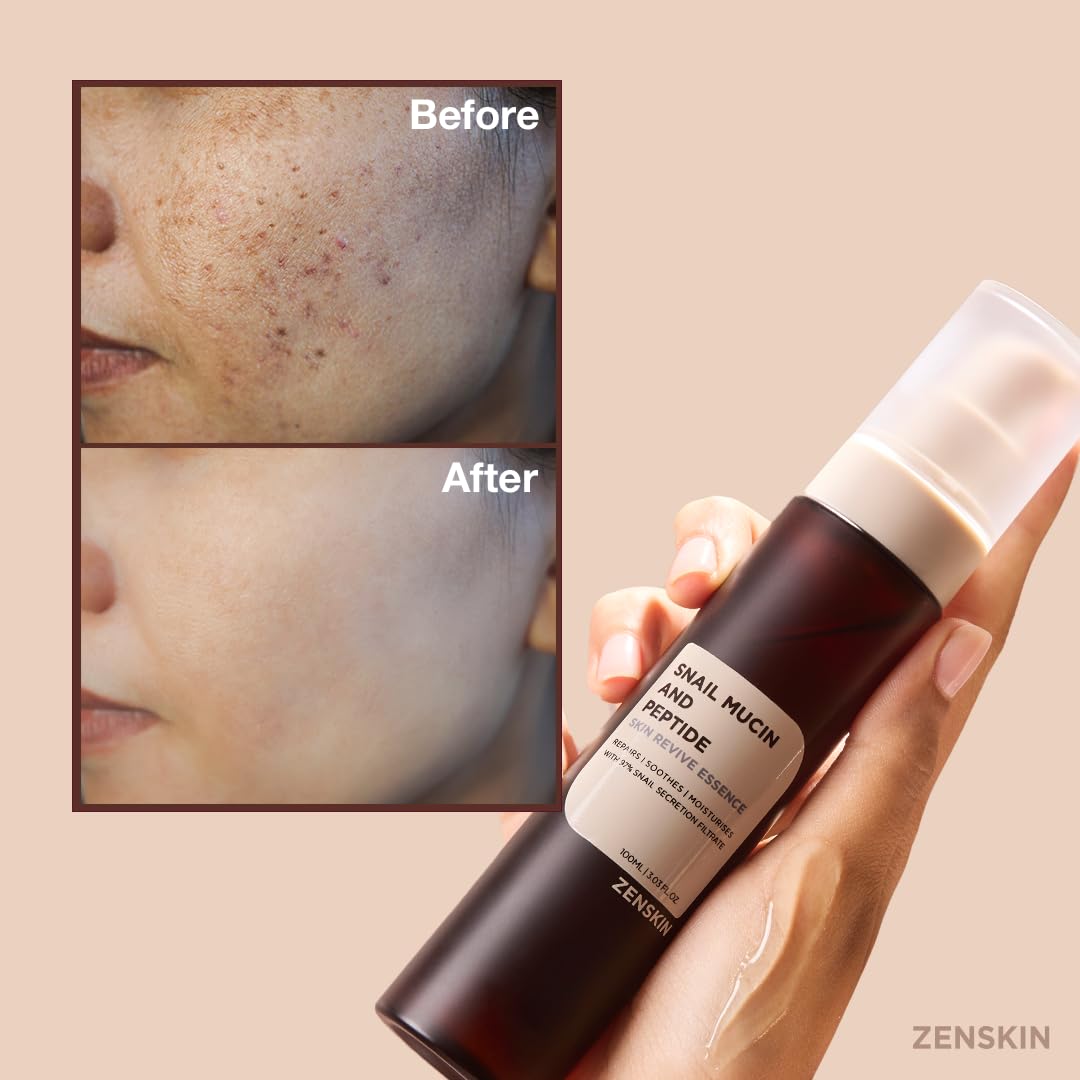 Snail Mucin Essence, Korean Hydrating Serum with Snail Mucin, Hyaluronic Acid, and Skin Revitalizing Ingredients for Smooth Skin, 100ml - Image 8