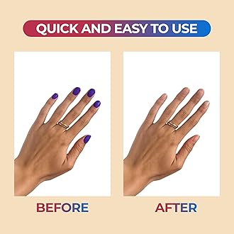 100% Pure Acetone Nail Polish Remover | Professional Quality | Easy To Use | Rapidly Removes Natural, Gel, Acrylic, shellac, and Glitter Nails | 8 Fl oz