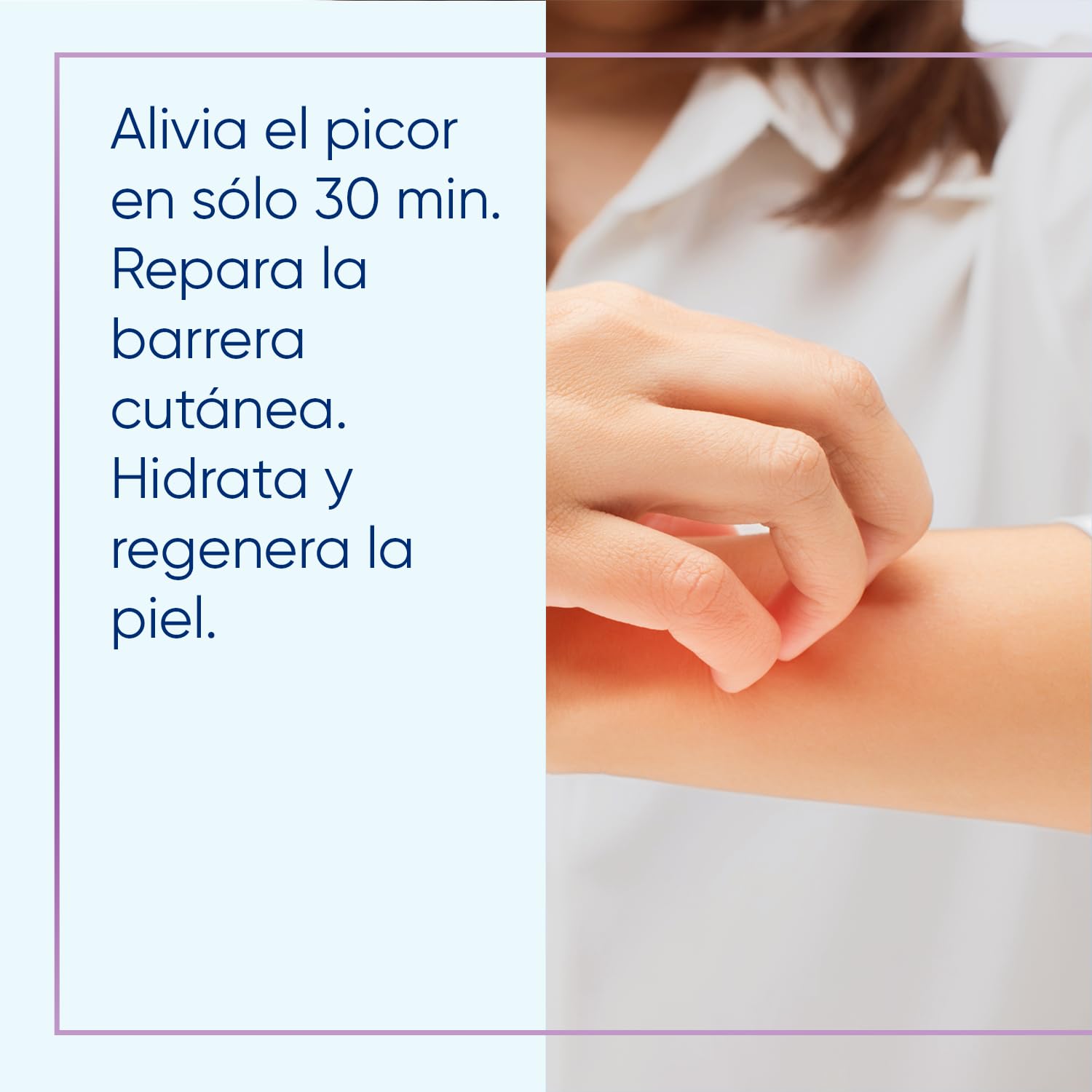 Bepanthol Derma SensiCalm para Aliviar el Picor y Enrojecimiento de las Irritaciones Cutáneas en Solo 30 Minutos, Sin Cortisona, 20 g — view 5