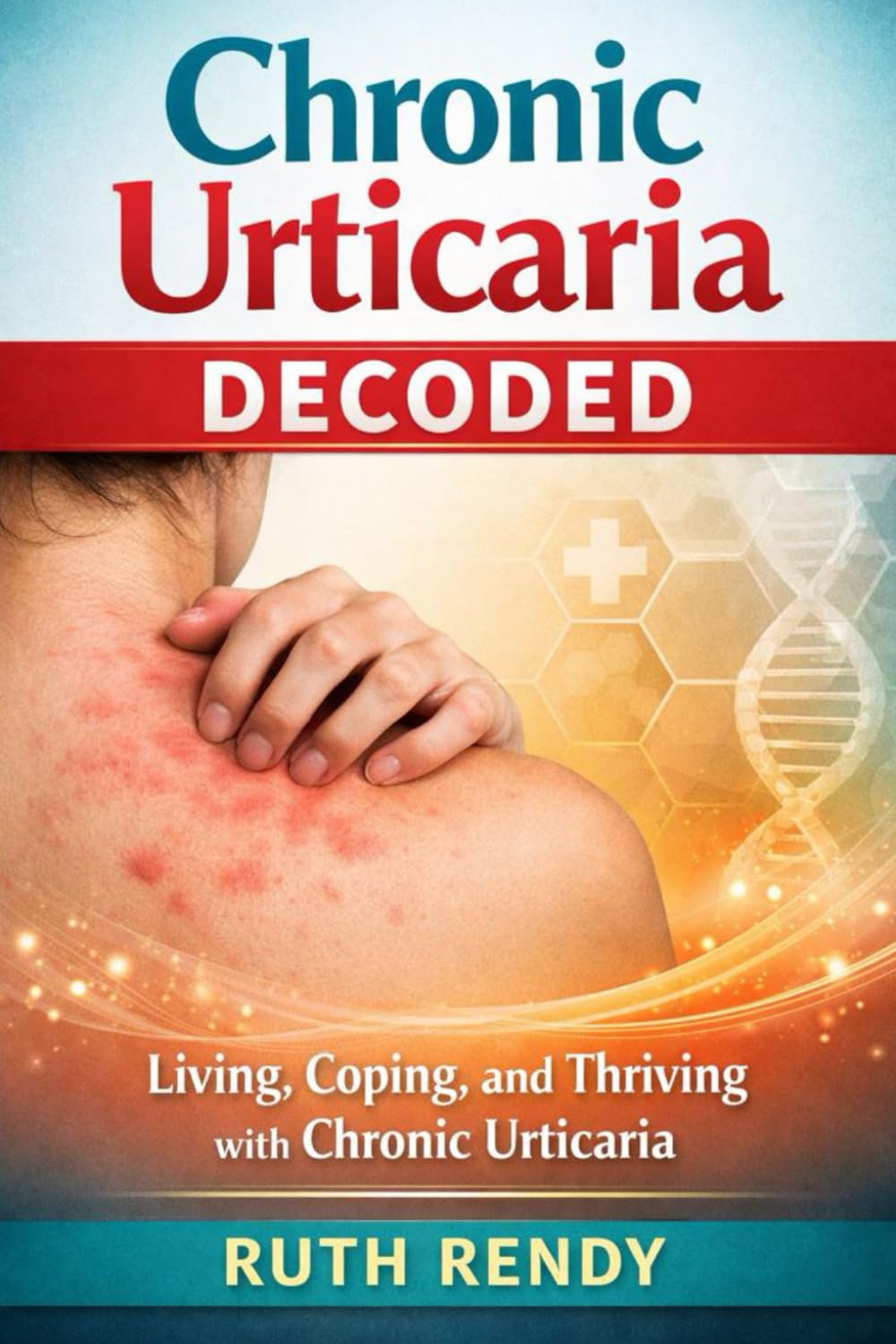 Chronic Urticaria Decoded: Living, Coping and Thriving with Chronic Urticaria
