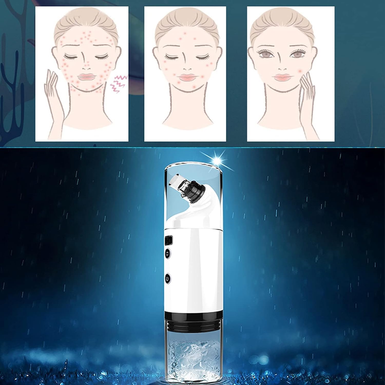 Elitzia Mitesserentferner Staubsauger, USB-Aufladung mit Akne/Komedonenextraktor, Hydra Tiefenreinigung, Maschine ET1010