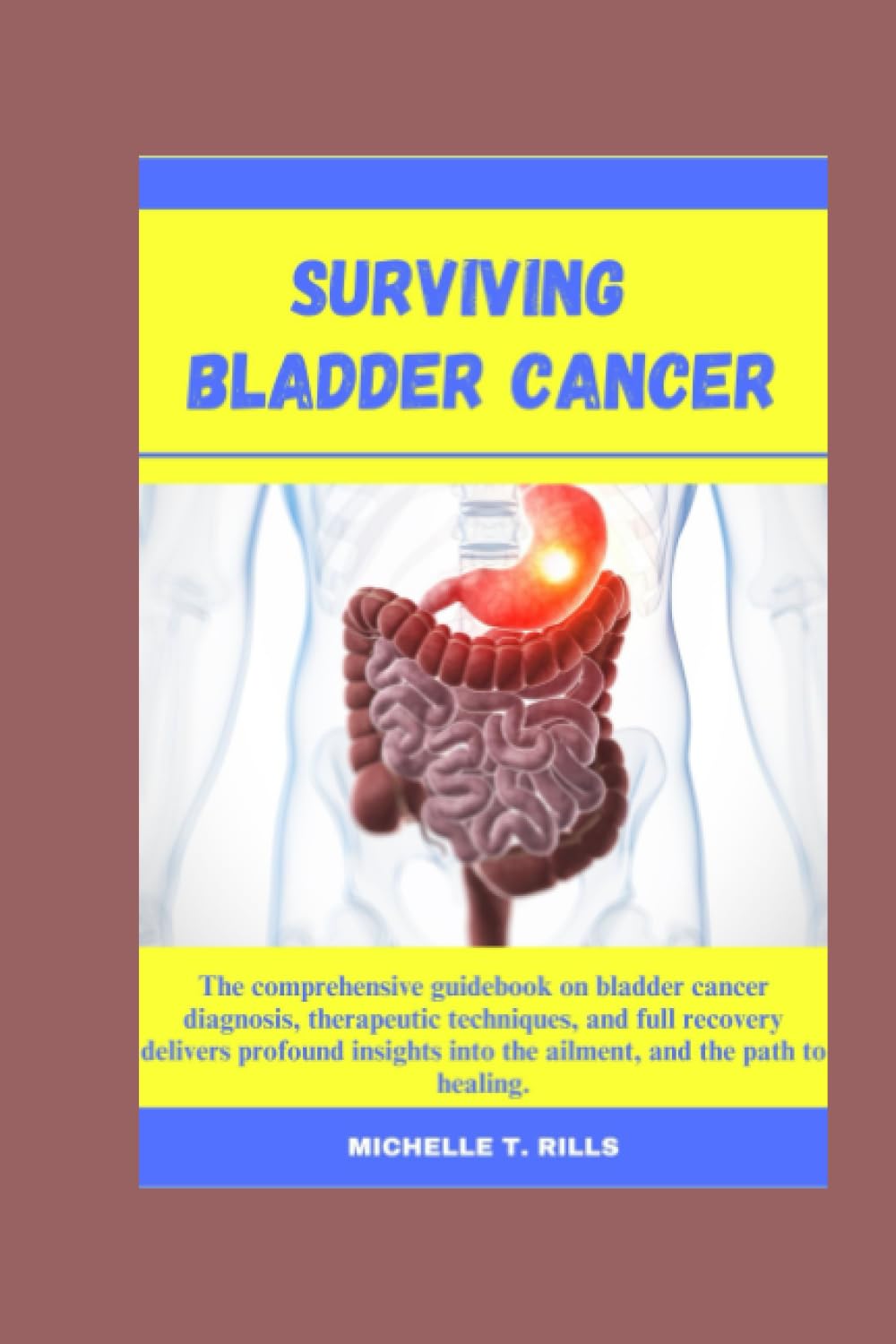 SURVIVING BLADDER CANCER: The comprehensive guidebook on bladder cancer diagnosis, therapeutic techniques, and full recovery delivers profound insights into the ailment, and the path to healing.