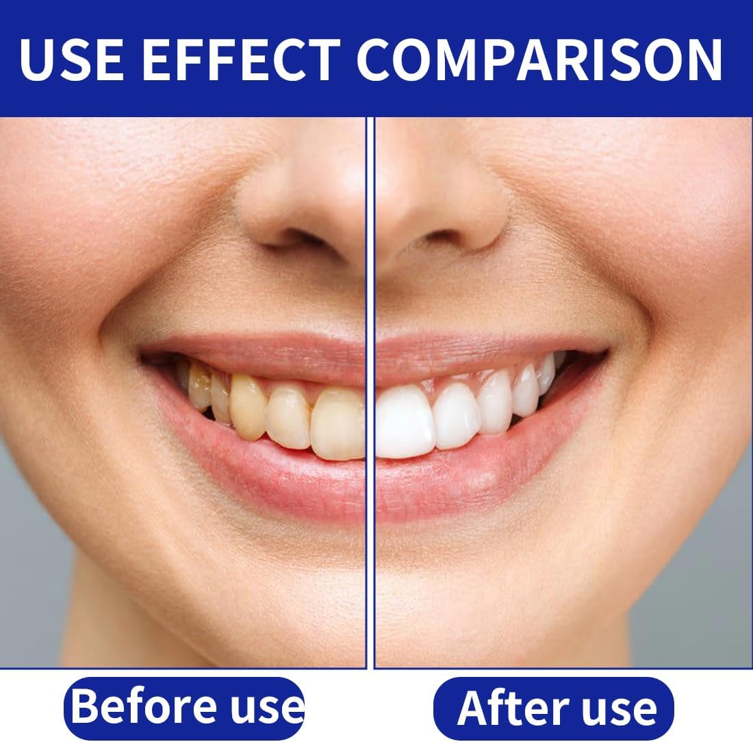 Tomedeks 28 Strips Teeth whitening Strips, Teeth whitening kit, Bamboo Charcoal