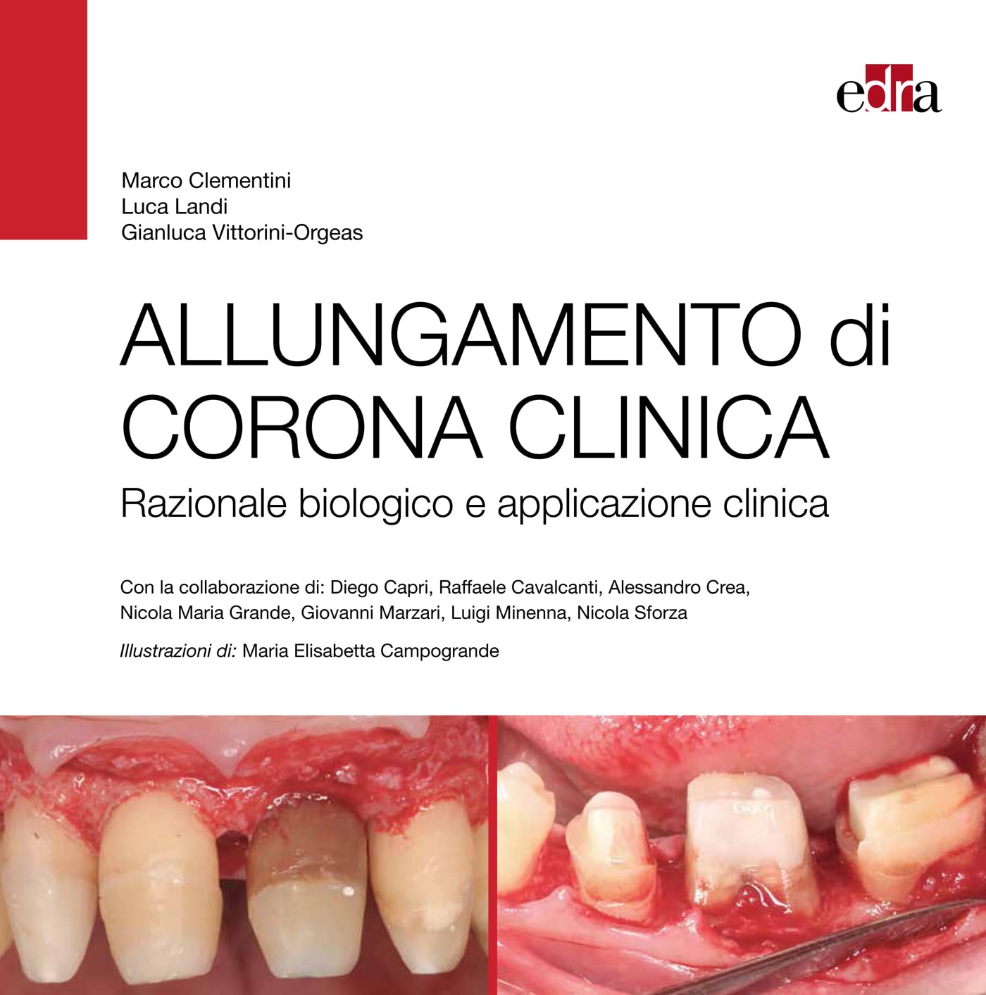 ALLUNGAMENTO DI CORONA CLINICA: Razionale biologico e applicazione clinica