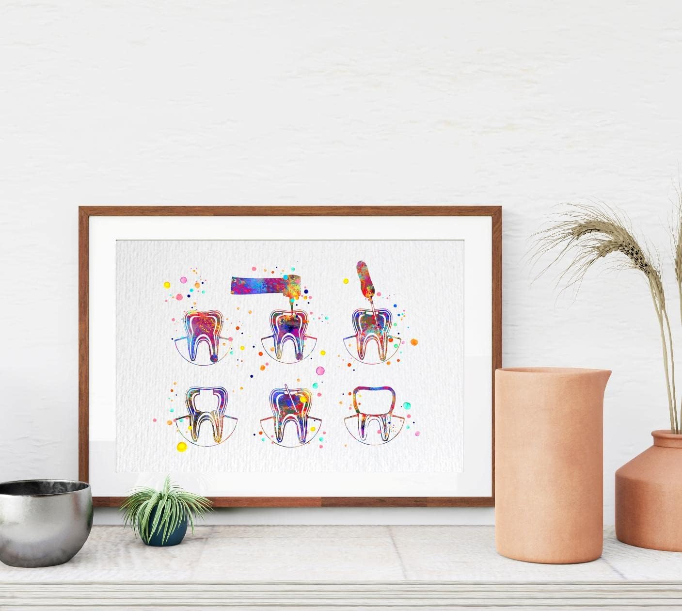 Dignovel Studios 11X14 Unframed Endodontics Therapy Treatment Tooth Watercolor Art Print Poster Root Canal Treatment Dental Clinic Décor Dentist Dentistry Office Medical Wall Décor DN750