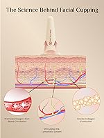 Vista 4 de Rena Chris Juego de Ventosas Faciales y Herramienta Facial Gua Sha - Juego de Ventosas de Silicona y Piedra Gua Sha de Cuarzo Rosa - Juego