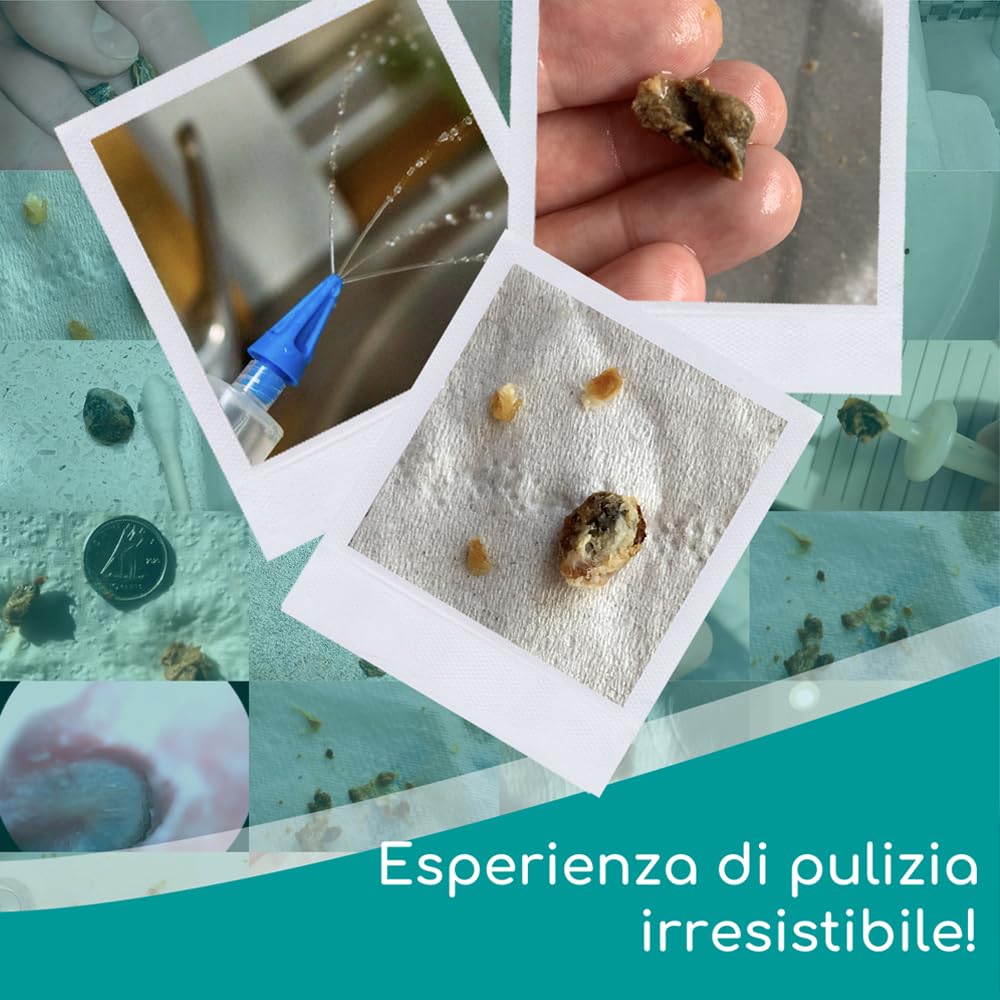 Medi Grade Kit Siringa Pulisci Orecchie – Siringa per Tappi Orecchie con 3 Punte a Getto Quadruplo –Kit per Pulizia Orecchie di Uso Domestico - Migliora la Chiarezza L’udito