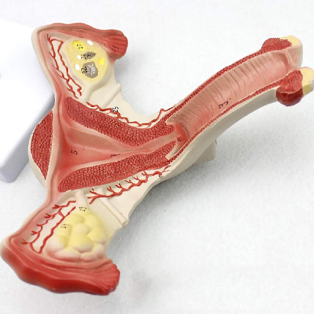 Teaching Model,Uterus Anatomical Model, Female Uterine and Ovarian Disease Model, Uterus and Ovary Reproductive Structure Gynecological Model, Female Internal Reproductiv