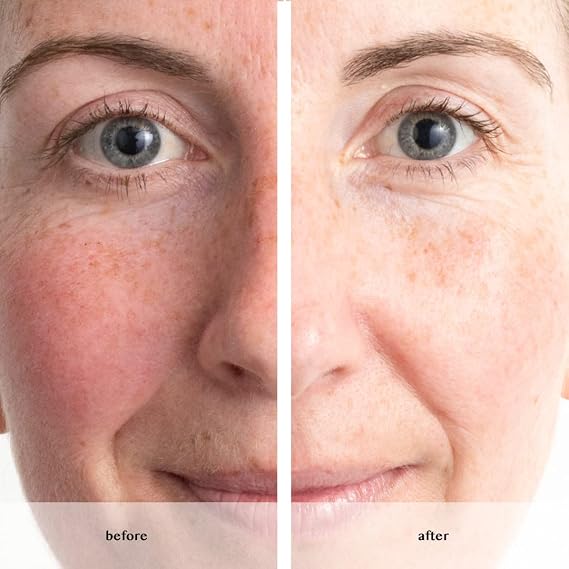Avon Anew Renewal Power Serum 30 Ml.