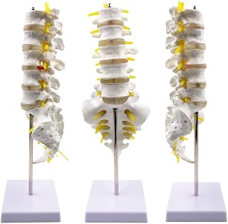 Product Medical Anatomical Model Lumbar Vertebrae w/Sacrum & Coccyx, with Herniation Disc