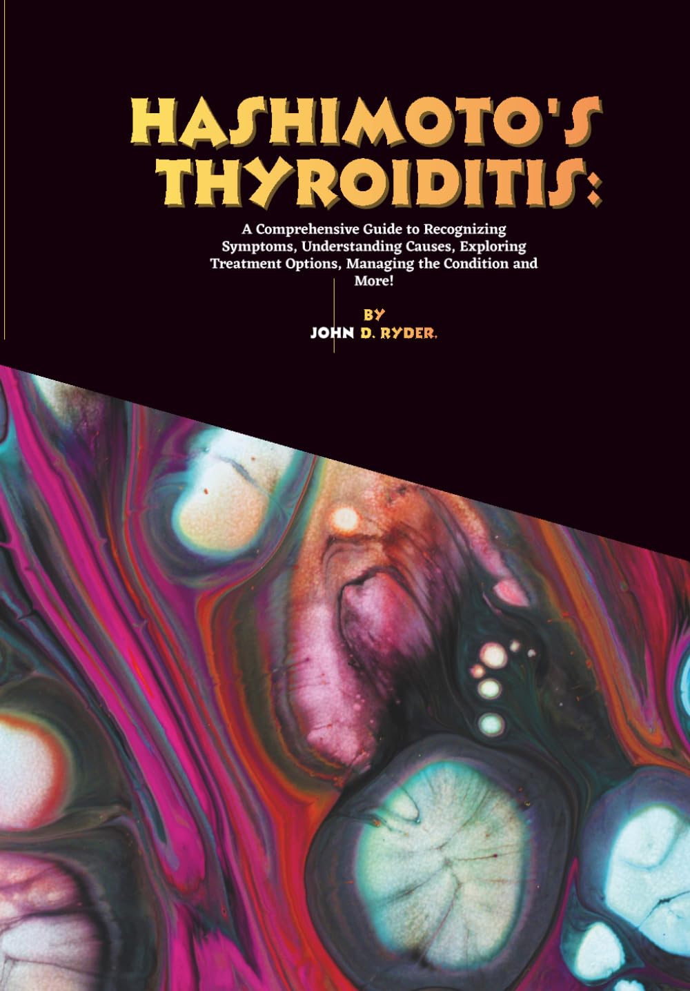 Hashimoto's thyroiditis: A Comprehensive Guide to Recognizing Symptoms, Understanding Causes, Exploring Treatment Options, Managing the Condition and More!