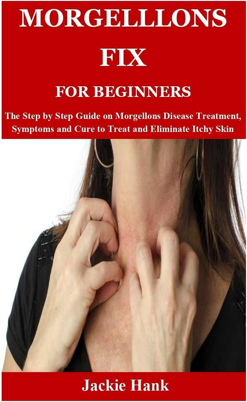 Morgelllons Fix for Beginners: The Step by Step Guide on Morgellons Disease Treatment, Symptoms and Cure to Treat and Eliminate Itchy Skin