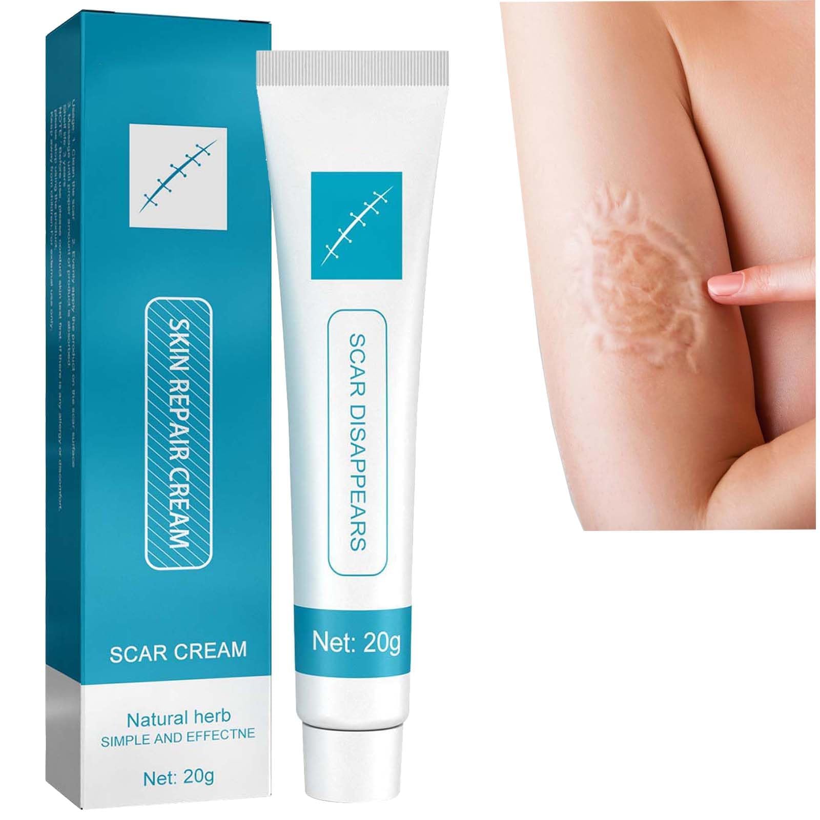 TERRIFI Silicone Scar Gel Cream for Old & New Scars, Effective Skin Repair for C-Section and Burns, Stretch Mark and Acne Scar Removal Treatment, 1 Pack