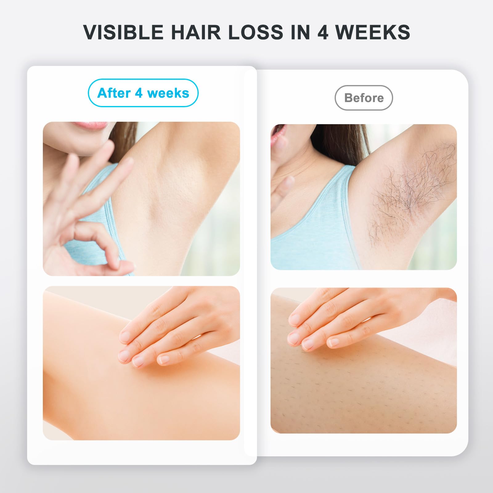 NALONE Epilatore Luce Pulsata, Luce pulsata professionale IPL, Epilatore Laser 999,900,Epilatore a luce pulsata IPL per Donne, Uomo, Gambe, Corpo, lunghezza d'onda fino a 1200 NM, due modalità